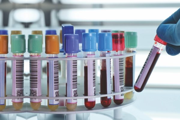 High-quality pathology reagents for diagnostic labs in Dehradun