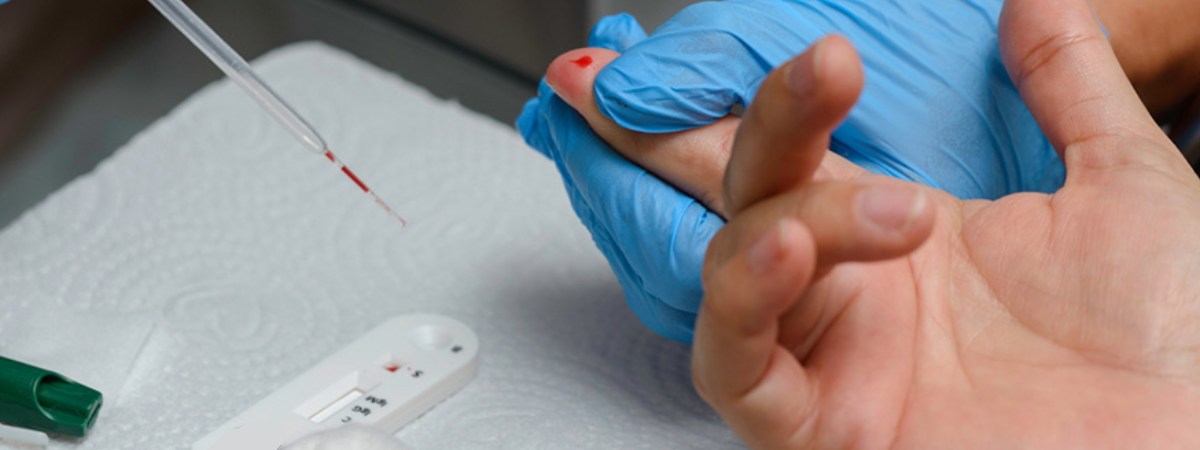 Rapid diagnostic test cards supplier for pathology labs in Dehradun